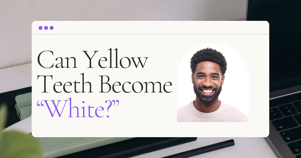 Can Yellow Teeth Become White?