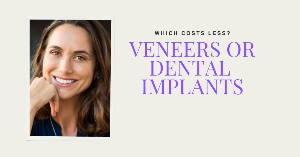 Veneers or Dental Implants?