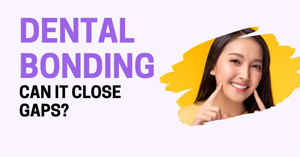 Dental Bonding